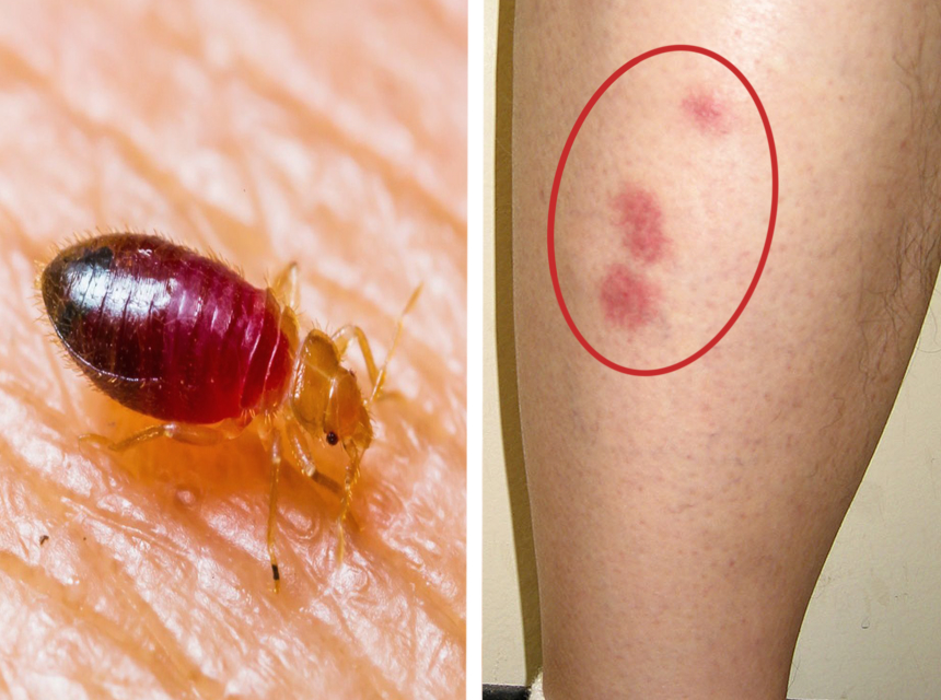 Everything about Bed Bug Shells: The Fist Sign of Bed Bugs
