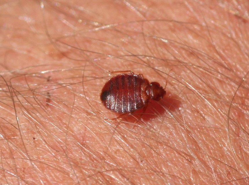 How Long Do Bed Bug Bites Last, and How to Treat Them?