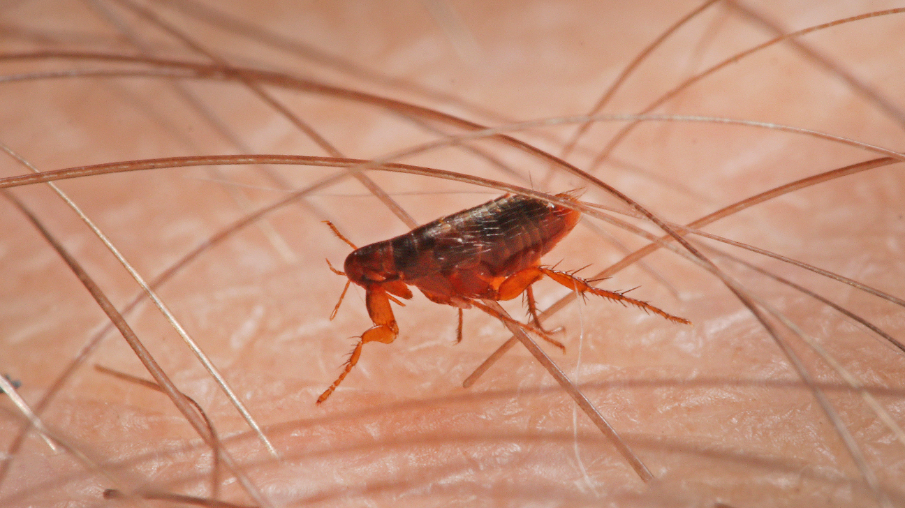 Can Fleas Live in Human Hair? Here's the Answer!