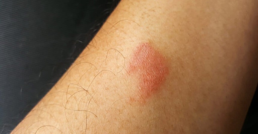 How to Get Rid of Centipedes and Prevent Their Return