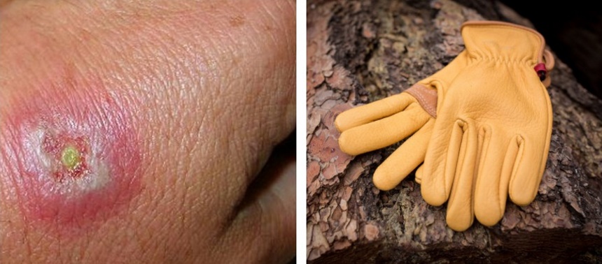 How to Get Rid of Hobo Spiders